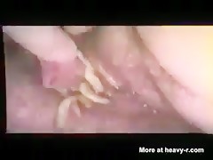 Thumb 20